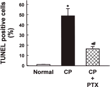 Figure 5. Quantitation of apoptotic cells in renal cortical tissues of normal, cisplatin (CP)-treated, and CP + pentoxifylline (PTX)-treated rabbits. Normal rabbits did not receive any drug. Data are means ± SEM of three animals in each group. *p<0.05 compared with the normal; #p<0.05 compared with CP alone.