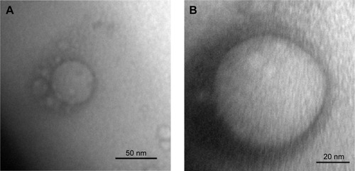 Figure 2 Transmission electron micrographs of ME at a magnification of 400,000× (A) and 800,000× (B), respectively.Abbreviation: ME, microemulsion.