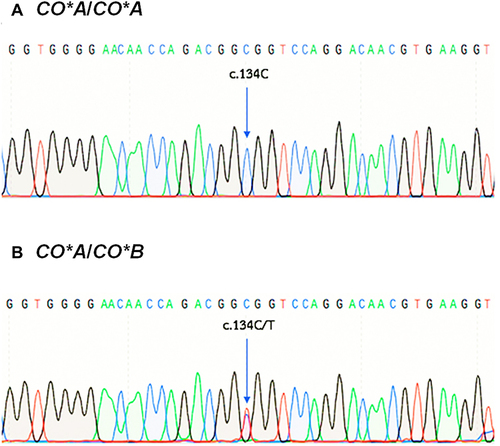 Figure 1 Electropherograms of the AQP1 Gene at the CO*A and CO*B Polymorphism Region, SNV c.134C>T (rs28362692). (A) Homozygous state of the c.134C identified in the CO*A/CO*A genotype and (B) Heterozygous state of the c.134C/T identified in the CO*A/CO*B genotype.