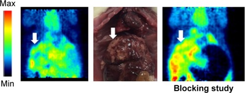 Figure 8 A representative comparison between the static PET images of ortho-[18F] F-1 in a CCA rat (left) and in the same rat using cold celecoxib (2 mg) as a blocker (right).