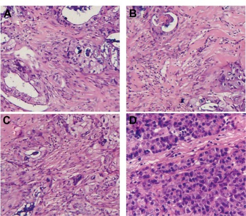 Figure 8 Hematoxylin and eosin assays of tumor tissues of the xenograft mice after various treatments.