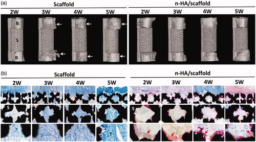 Figure 5. (a) Micro-CT–reconstructed images of the implants and adjacent bone tissue. B: bone; S: scaffold; arrows show adjacent cortical bone resorption by tumor. (b) Histological observation of the implanted scaffolds. S: scaffold; T: tumor; red arrows indicate new bone formation (Zhang, Zhou, et al., Citation2019).