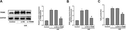 Figure 3 TRIM8 inhibition attenuated oxidative stress induced by H/R in HK-2 cells. (A) Transfection efficiency was confirmed by Western-blot. (B and C) TRIM8 inhibition suppressed the production of ROS and H2O2. All results are from three independent experiments. Data are presented as mean +SD. *P < 0.05, relative to control group; #P < 0.05, relative to the H/R + si-NC group.