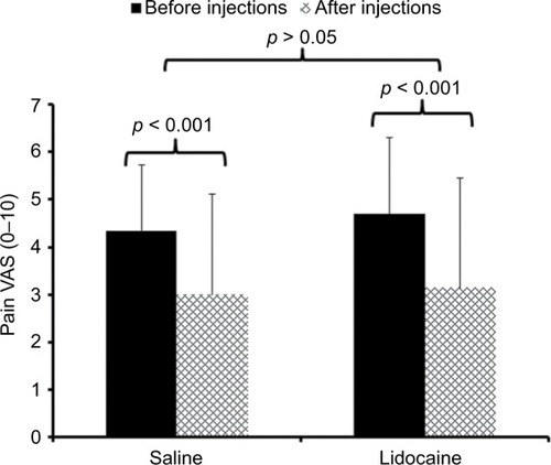 Figure 2 Mean (SD) pain ratings of participants with CFS before (black bars) and after (hatched bars) muscle injections with 1% lidocaine or normal saline.