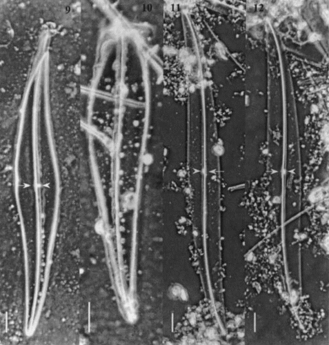 Figs 9 – 12. Light micrographs of Gyrosigma spp. Figs 9, 10. Gyrosigma nipkowii (holotype slide # 3203024 from Meister collection (Z), Bay of Amoy, China). Fig. 9. Whole valve showing a distinct white spot at centre (arrowhead) with opposing central bar (arrow) and wide axial costa. Fig. 10. Broken valve. Figs 11, 12. Gyrosigma pallidum (holotype slide G.C. # 62630 from Riznyk collection (ANSP), Yaquina Estuary, USA). Whole valve exhibiting a distinct axial costa, a narrow central bar (arrow) with an opposing white spot (arrowhead). All scale bars represent 10 μm.
