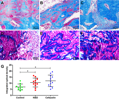 Figure 7 Assesment of new bone tibia defects using Masson staining in the control (n=10) (A and D), NBD (n=11) (B and E), and cefazolin (n=12) (C and F) group at 4 weeks postoperatively. Quantitative analysis demonstrated improved osteogenic activity, and most defect areas in the NBD and cefazolin groups were filled with newly formed bone tissue (D). *p<0.05 (G). pAll samples of animals were examined.