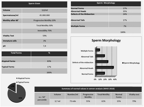 Figure 1. Semen analysis (sperm count, motility, and morphology) performed by patient during dabrafenib and trametinib, and relative normal ranges.