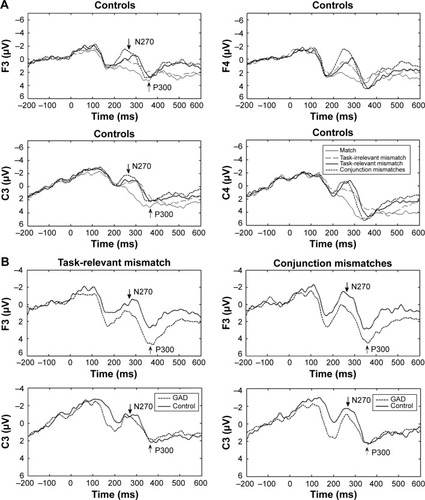 Figure 1 The grand-averaged ERPs for the GAD group and the control group.