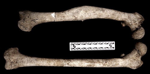 fig 9 Norton East Mill 91. Fracture and consequent shortening of the right femur of NEM-91 (in comparison to left) which probably resulted in an abnormal gait. Photograph by S Bohling with permission of Tees Archaeology.