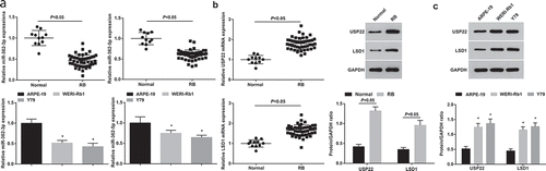 Figure 1. MiR-362-3p and miR-362-5p expression is decreased while USP22 and LSD1 expression is increased in RB tissues and cells. (a), Expression of miR-362-3p and miR-362-5p in RB tissues and cell lines tested by RT-qPCR. (b), Expression of USP22 and LSD1 in RB tissues tested by RT-qPCR. (c), Expression of USP22 and LSD1 in RB cell lines WERI-Rb1 and Y79 tested by western blot assay. * P < 0.05 vs. ARPE-19 cells. + P < 0.05 vs. normal group. Normal (n = 11), RB (n = 46), WERI-Rb1, Y79, ARPE-19 (N = 3). Measurement data were depicted as mean ± standard deviation, comparison between two groups was conducted by t test, comparisons among multiple groups were assessed by one-way ANOVA followed with Tukey’s post hoc test