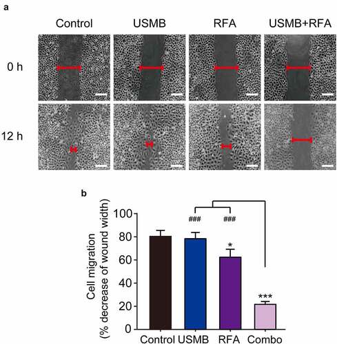 Figure 2. Effects of USMB and RFA combination therapy on inhibiting Panc02 cell migration (Scale bar = 100 μm). (a) The image and (b) decrease of wound width of Panc02 cell migration. *p < 0.05, **p < 0.01 and ***p < 0.001 vs. Control group; ###p < 0.001 vs. Combo group. Scale bar, 100 μm. All data were presented as mean ± SD (n = 6)