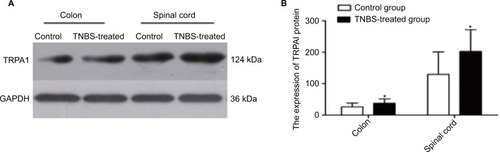 Figure 2 (A) Western blotting image of TRPA1 and GAPDH expression in the colon and spinal cord of the rats from the control and TNBS-treated groups (n=12 per group). The top panel was the target band, TRPA1 protein (124 kDa) and the bottom one was for the loading control GAPDH (36 kDa). For the TRPA1, the TNBS-treated group showed much stronger and wider signal compared with the control group accordingly. (B) Western blotting quantitative analysis of the TRPA1 expression in the rat’s colon and spinal cord of the control and TNBS-treated groups. Expression of TRPA1 was significantly greater in the TNBS-treated group than in controls (P<0.05).