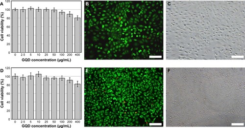 Figure 3 Viability studies of GQDs performed in DU-145 (A, B, and C) and PC-3 (D, E, and F) prostate cancer cell lines.Notes: The quantification of viable cell number upon 24 h exposure to different concentrations of GQDs was performed with a CCK-8 kit (A and D). Specific staining of live (green) and dead (red) cells (B and E) was also performed after 24 h incubation with 200 µg/mL GQDs concentration. The corresponding images of the stained cells with transmitted light are also presented (C and F). The scale bars of figures B, C, E, and F represent 50 µm.Abbreviations: GQD, graphene quantum dot; h, hours.