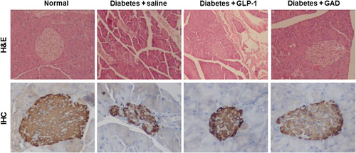 Figure 5. GAD treatment reduced the tissue damage in the pancreas of the diabetic mice. Up panel, H&E staining of the pancreas sections; down panel, IHC staining against insulin in the islet. The magnification was set at 400-fold.
