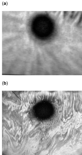 Figure 2 The appearance of the precorneal tear film lipid layer, (a) intact and (b) disrupted.