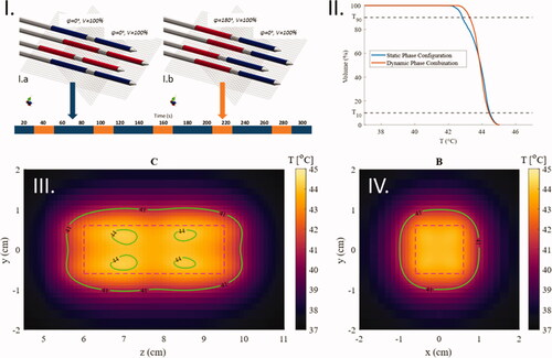 Figure 11. Temperature maps after 5 min of heating in an agar phantom with a dynamic combination of two phase configurations. (I) The phase schedule applied during the heating time. (II) CTVH comparison between the static phase configuration and the dynamic phase configuration in the VOI presented in the temperature maps (III and IV). (III) The central plane parallel to the applicators (cross-section C in Figure 3). (IV) The plane in the center of the active length of the applicators (cross-section B in Figure 3).