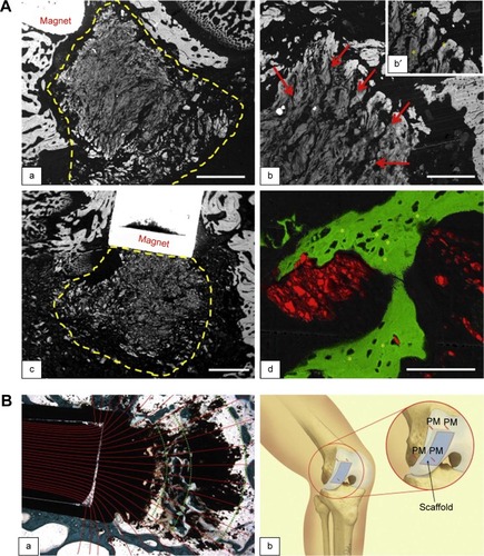 Figure 3 (A) SEM images of new bone tissue growing inside and around magnetic scaffolds: (a) MAG-A; (b) a detail of MAG-A; and (c) MAG-B at 4 weeks. Scaffold delimited by yellow dashed line; red arrows show mineralization. (b′ and d) Osteocyte lacunae (indicated by asterisks) in the new bone grown inside MAG-A and MAG-B, respectively. Scale bars: (a and c) 1.0 mm; (b) 300 μm; and (d) 100 μm. Reprinted from Panseri S, Russo A, Sartori M, et al. Modifying bone scaffold architecture in vivo with permanent magnets to facilitate fixation of magnetic scaffolds. Bone. 2013;56(2):432–439. Copyright 2013, with permission from Elsevier.Citation92 (B) Merged images in (a) show magnetic field lines coming out from permanent magnet and resulting scaffold orientation. (b) Schematic presentation of magnet–scaffold fixation with four implanted permanent magnet pins (PM) that hold an osteochondral scaffold. Reprinted from Panseri S, Russo A, Sartori M, et al. Modifying bone scaffold architecture in vivo with permanent magnets to facilitate fixation of magnetic scaffolds. Bone. 2013;56(2):432–439. Copyright 2013, with permission from Elsevier.Citation92Abbreviations: MAG-A, magnetic scaffold A; SEM, scanning electron microscopy.