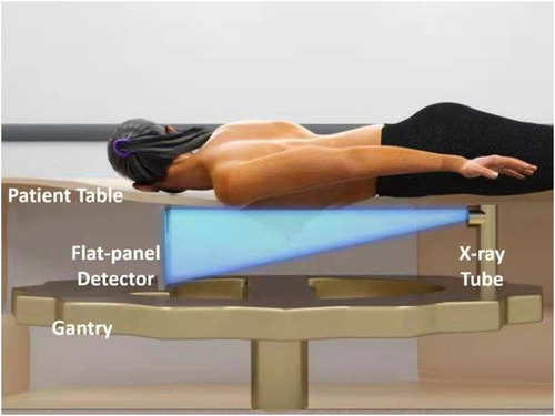 Figure 1 The patient is in the prone position, and the breasts naturally sag through the hole in the center of table. The X-ray tube and detector scan a circle around the breast to obtain a two-dimensional breast projection image. From this a three-dimensional image is reconstructed and uploaded to the image processing system and workstation.