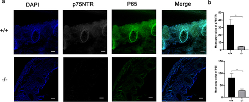 Figure 5. Immunohistochemistry exhibited similar expression patterns for p75NTR and NF-κB. (a) The confocal laser scanning microscopy results revealed that p75NTR and P65 were strongly expressed in the spine of the trunk of p75NTR+/+mice, but weakly expressed in p75NTR−/−mice. (b) Quantifications of immunostaining for p75NTR and P65. The data are presented as mean ± SD, n = 3, *P < 0.05. Scale bar, 50 μm.