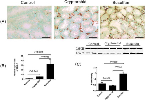 Figure 3. Lipocalin-2 (LCN2) mRNA and protein expression in mouse testes. (A) Shows increased positive hybridization in both testis of induced cryptorchidism and busulfan-treated mice. (B) A significant increase in LCN2 expression by real-time PCR between the control group and the experimental groups (p<0.05). LCN2 expression was higher in busulfan-treated testis than that of cryptorchidism testis (p<0.05). (C) Shows a significant increase in LCN2 protein levels by western blot analysis in the busulfan-treated group (p<0.01). But there was no significant difference in LCN2 protein levels between the control group and the induced cryptorchidism group (p>0.05). Bar = 50 μm.