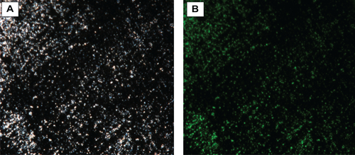 Figure S5 Fluorescence microscopy images of (A) PLGA-PEG-peptide-Rho NPs and (B) green emission of all scanned NPs.Abbreviations: NPs, nanoparticles; PEG, polyethyleneglycol; PLGA, poly(lactic-co-glycolic acid); Rho, 5(6)-carboxytetramethylrhodamine.