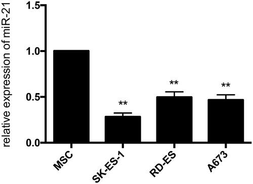 Figure 9. The expression of miR-21 in Ewing sarcoma cell lines. The expression levels of miR-21 were lower in each ES cell line contrasted with hMSC cell line by quantitative real-time PCR analysis.