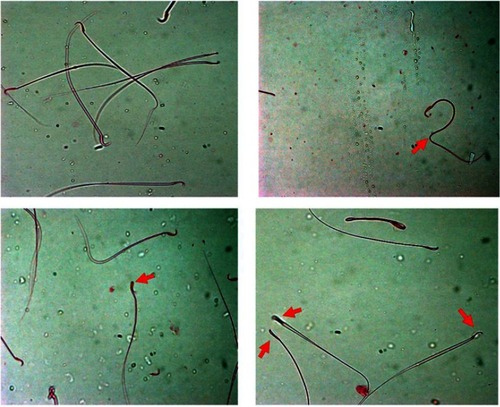Figure 1 Effect of piceatannol treatment on abnormal sperm (arrow).