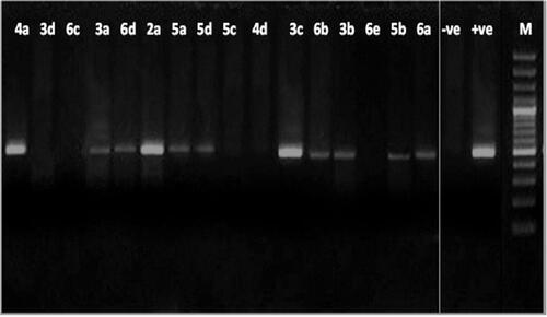 Figure 4. Agarose gel electrophoresis showing the effect of the tested compounds on the nucleic acid of the pathogenic fungus F. oxysporum. From right to left: lane 1marker (M), lane 2 (positive control), lane 3 (negative control) lane 4 to 19 (fungal DNA treated with the synthetic compounds.
