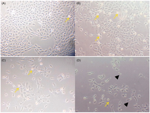 Figure 3. Morphological changes of MCF-7 cells treated with 25 μg/mL of E. hirta extract for (B) 24 h, (C) 48 h, and (D) 72 h viewed under an inverted light microscope. Control (A) was also included (200 × magnification). Arrows showed cell shrinkage and nuclear condensation due to apoptosis. Arrowheads showed the presence of apoptotic bodies.