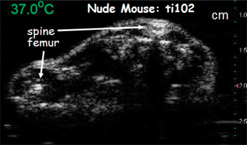 Figure 4. Ultrasonic image of a live nude mouse. Focal zone of the 7.5 MHz transducer was at 2 cm.
