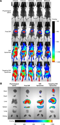 Figure 8 Imaging of distribution in the intracranial glioma-bearing nude mice after intravenous administration of targeting DiR liposomes.Notes: (A) In vivo real-time imaging of distributions of different formulations within 48 hours. (B) Ex vivo imaging of distributions of different formulations in brain tissues and major organs after mice were killed at 48 hours.Abbreviation: DiR, 1,1-dioctadecyl-3,3,3,3-tetramethylindotricarbocyanine iodide.