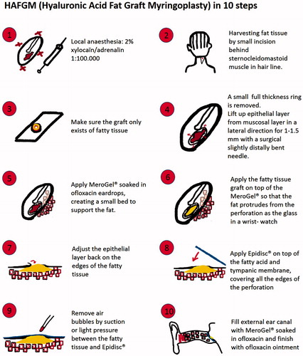 Figure 1. Our surgery protocol in 10 steps [Citation15].