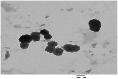 Figure 1. Transmission electron microscope image of lipid-polymer hybrid nanoparticles.