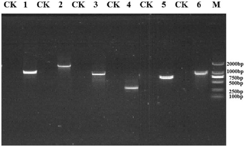 Figure 6. Agarose gel electrophoresis of RT-PCR assay for detection of estrogen degrading enzyme expression in the presence of E1.