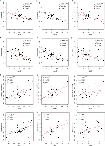 Figure 4. Correlation between IVUS data and hemodynamics. abc: Compliance; def: Distensibility; ghi: Elasticity modulus; jkl: Stiffness index β. Nonlinear regression analysis was conducted on all patient data. Results showed that there was significant power correlation between pulmonary vascular mechanical performance and pulmonary artery hemodynamics.