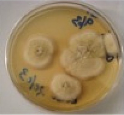 Figure 9 Trichophyton tonsurans.