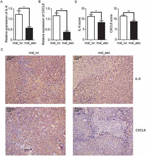 Figure 7. In vivo knockdown of MALAT1 inhibits inflammatory response in HCC tissues. A, B) RT-qPCR analysis of IL-6 A) and CXCL8 B) expression in HCC xenografts two weeks after intratumoral injection of cholesterol-conjugated MALAT1 silence (mal-aso) or negative control (mal-nc). C) Detection of IL-6 and CXCL8 by IHC in HCC tissues was performed two weeks after intratumoral injection of cholesterol-conjugated MALAT1 silence mal_aso or mal_nc. Scale bars = 50μm. D) IHC staining score of IL-6 and CXCL8 was made in mal_aso and mal_nc groups. Data are shown as mean± s.e.m. (n = 3) (A, B and D). Data are shown one representative experiment (C). Similar results were obtained in three independent experiments. * P < 0.05, ** P < 0.01.