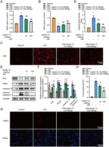 Figure 4. Apellin13 treatment reduced the oxidative stress and apoptosis in rat kidney tissues. Rats were treated as described above. The expression of Keap1, Nrf2 in renal tissues was assessed by immunoblot analysis. Oxidative stress in renal tubular cells was assessed using dihydroethidium (DHE). Apoptosis levels of renal tubular cells were assessed using TUNEL staining. (A) Renal MDA content. (B) Renal GSH activity. (C, D) Representative images of DHE staining and semi-quantitative analysis of DHE fluorescence intensity, Scar bar, 100 μm. (E, F) Representative immunoblot analysis and semi-quantitative analysis of Keap1, Nrf2, caspase-12 and Cleaved caspase-3 in rat kidney tissues, GAPDH was used as a loading control. (G) Representative images of TUNEL staining. The apoptotic cells were detected by TUNEL (red), and the nuclei were detected by DAPI (blue). Scar bar, 100 μm. (H) Quantitative analysis of TUNEL staining positive cells. *p < 0.05, **p < 0.01, significantly different from control group; #p < 0.05, ##p < 0.01, significantly different from the CM group. All quantitative data are expressed as means ± SEMs, n = 3.