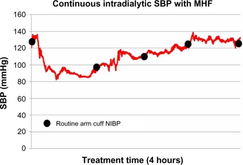 Figure 4 Detail of the MHF regression product from continuous SBP monitoring compared with standard intermittent brachial SBP readings.