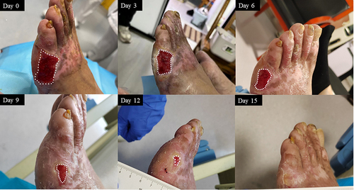 Figure 7 Representative images of the healing process in case 7.