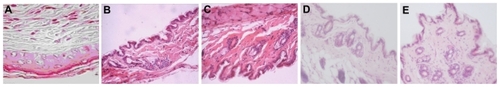 Figure 4 Histopathology of skin tissues of mice after allo-HSCT [hematoxylin and eosin, magnification ×4 (objective lens)]. (A) Control group; (B) irradiation-only group; (C) Fe3O4 MNPs-treated group; (D) CsA-treated group; (E) CsA + Fe3O4 MNPs-treated group.Abbreviations: allo-HSCT, allogenetic hematopoietic stem cell transplantation; CsA, cyclosporine A; Fe3O4 MNPs, Fe3O4. magnetic nanoparticles.