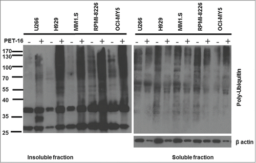 Figure 2. PET-16 induces proteotoxic stress in MM cells. MM cells were treated with PET-16 (3 μM) for 24h. Cells were then collected and protein lysates were prepared. Detergent soluble and insoluble fractions were resolved on a 10% acrylamide gel. Ubiquitinated protein levels were detected by Western blotting. The results depicted are representative of multiple independent experiments.
