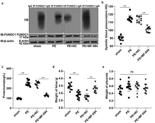 Figure 5. Increased ubiquitination level of FUNDC1 alleviated cell injury in PE mice. A: the ubiquitination levels of FUNDC1 in each mice were detected by COIP, N = 12; B-C: tail artery systolic pressure and urine protein were detected by tail-cuff and CBB method, N = 12; D-E: the weight of animal fetus and placenta was measured, N = 12. Data were analyzed using one-way ANOVA, followed by Tukey’s Multiple comparisons test, **P < 0.01.