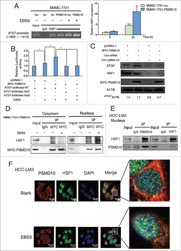 Figure 5. PSMD10 associates with HSF1 to cooperate in the expression of ATG7. (A) ChIP assay of the ATG7 promoter containing HSF1 binding sites from −1809 to −1412 was performed to measure the effect of PSMD10 on the binding activity of HSF1 under EBSS starvation for 24 h (left panel). Quantification of the ratio of HSF1 binding to IgG (lower panel). (B) The effect of PSMD10 on ATG7 reporter activity. SMMC-7721 cells were transiently cotransfected with pcDNA3.1/MYC-PSMD10 and ATG7 WT/mut1/mut2 luciferase plasmids. Luciferase activities were detected at 24 h after transfection and EBSS starvation. Data represent mean (±SD) from 3 independent experiments (*P < 0.05). (C) SMMC-7721 cells were transiently cotransfected with pcDNA3.1 or MYC-PSMD10 and a nonspecific RNAi control or siHSF1 RNA #3, and the indicated molecules were detected after EBSS starvation for 24 h. Data represent mean (±SD) from 3 independent experiments (*P < 0.05). (D) Cytoplasmic and nuclear fractionation from SMMC-7721-PSMD10 cells was performed for coimmunoprecipitation with MYC-tag antibody, followed by probing with anti-HSF1 or MYC-tag antibody. (E) HCC-LM3 cells treated with EBSS for 24 h were immunoprecipitated and immunoblotted for the indicated molecules. (F) HCC-LM3 cells were immunostained for endogenous PSMD10 and HSF1 to observe their colocalization in the presence or absence of EBSS for 24 h. DNA was stained by DAPI. Representative confocal microphotographs are shown together with profiles of colocalization within the area of interest (yellow signals in the nucleus).