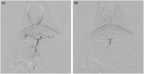 Figure 1. Arterial angiogram of a rabbit liver (A) before embolization and (B) immediately after embolization with CBDOX and PVA. The hepatic artery trunk was occluded with CBDOX and PVA after embolization.