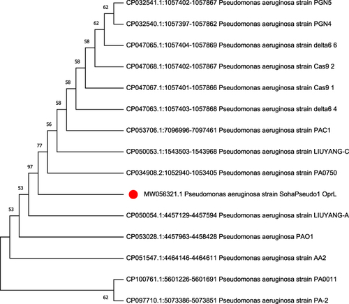 Figure 2 The phylogenetic analyses of the oprL gene sequencing: the tree elucidates the genetic similarity of the recovered P. aeruginosa strain and other strains placed in the GenBank database. The P. aeruginosa strain in the current work is noticeable with a red circle.
