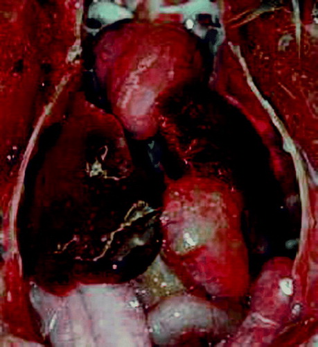 Figure 1.  In-situ view of an Amazon parrot carcass (A. xanthops) showing mild hepatomegaly with multiple small necrotic foci.