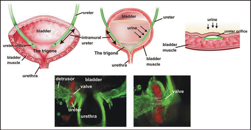 Figure 2 The Bladder Trigone. Top: Schematic of the ureteral valve mechanism and its physical relationship to the trigone. The trigone is a muscular structure located at the base of the bladder. When the bladder fills with urine, the trigonal muscle helps compress the ureteral orifice preventing back-flow of urine to the ureters and kidneys, which can cause severe damage. Bottom: The mouse ureteral valve. A vibratome section of a P0 urogenital tract stained with smooth muscle alpha actin (green) and uroplakin (red).