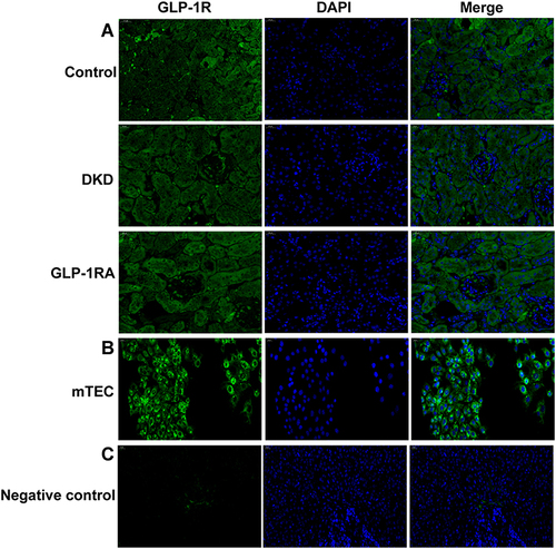 Figure 5 GLP-1R is widely expressed in renal tubules of mice and mTEC cells. (A) Immunofluorescence staining of GLP-1R (green) was performed on the kidney sections of mice in the three groups (n = 3) (400×). (B) Immunofluorescence staining of GLP-1R (green) was performed on the mTEC cells (n = 3) (200×). (C) Immunofluorescence staining of GLP-1R (green) was performed on the ovary sections of mice as a negative control (n = 3) (400×).