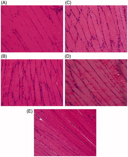 Figure 4. Histological observation of skeletal tissues in experimental rats (HE staining, 40×), (A) NC group, (B) DBC group, (C) RSG group, (D) TCM group and (E) FME group.